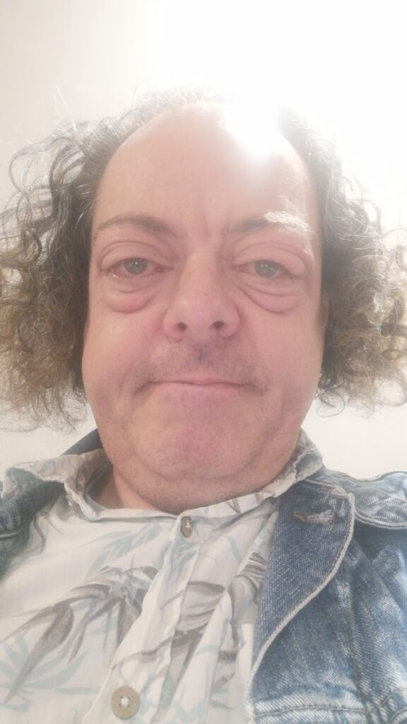 Six weeks into op - during radiotherapy