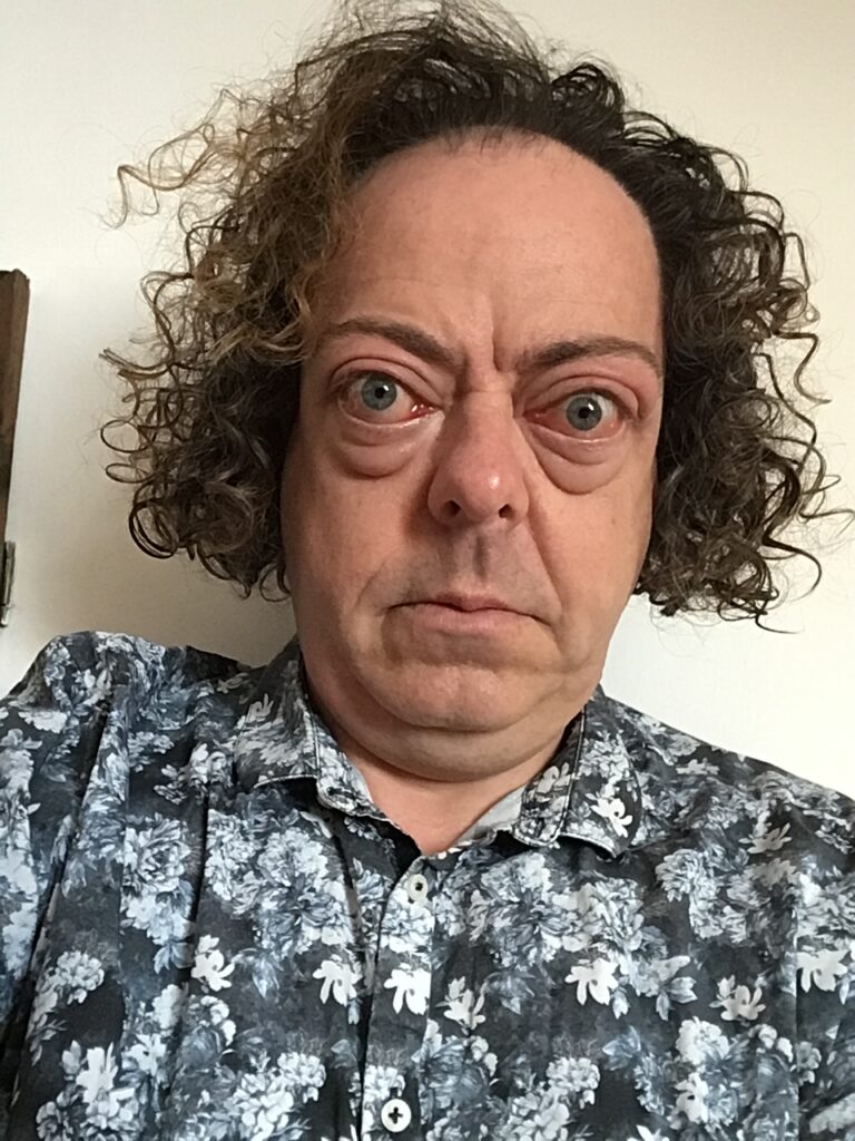 Pre-operation