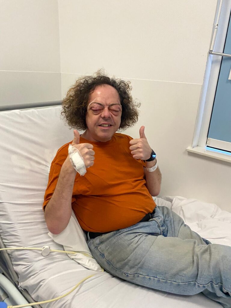 Post-op