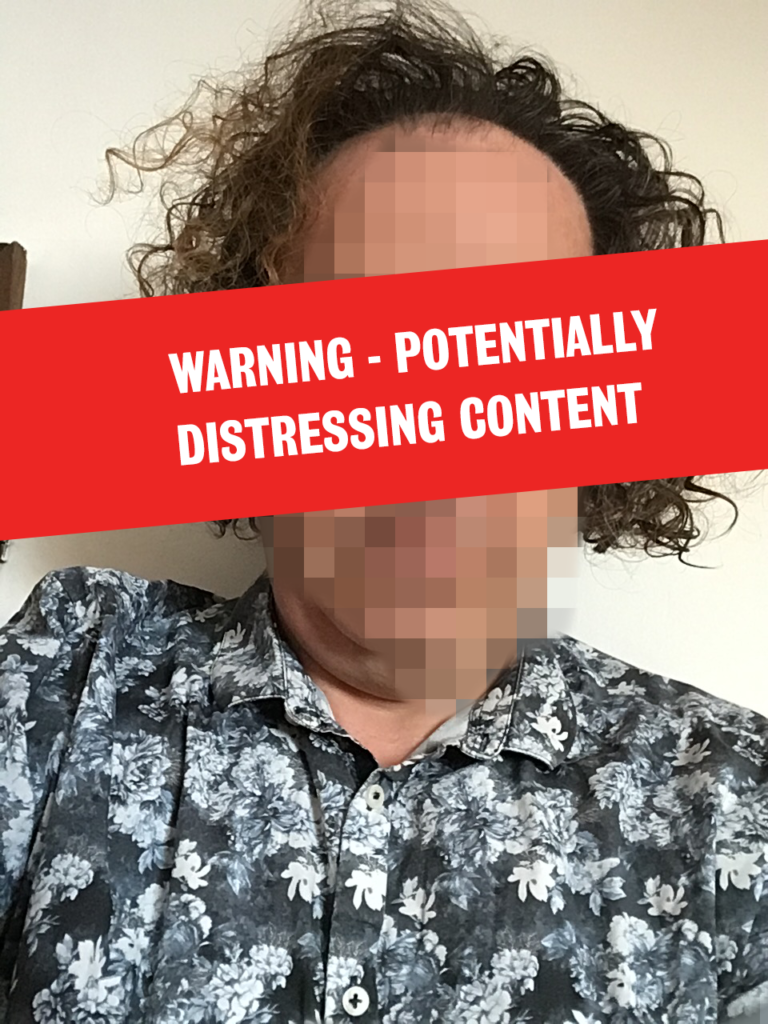 Warning - potentially distressing photos